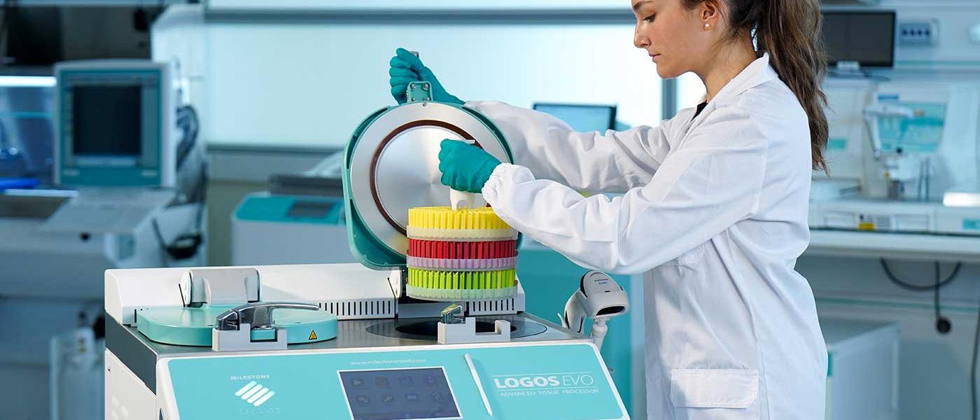 Frequently Asked Questions on Tissue Processing