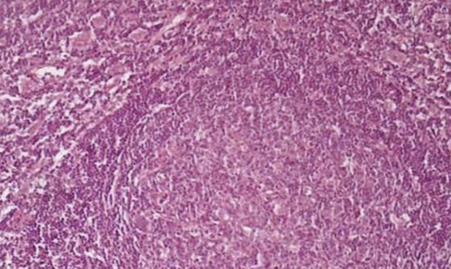 lymphnode with a germinal center stained with HE, treated with an improper fixation