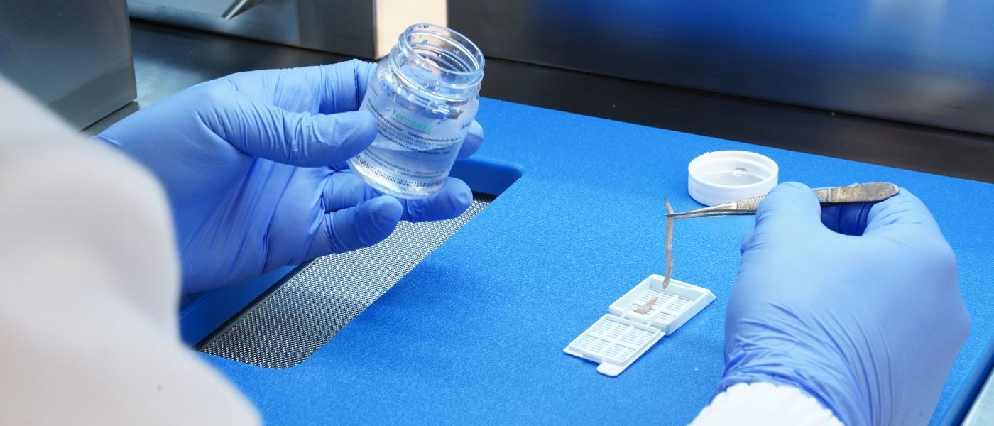 Step-By-Step Guide to Streamlined Biopsy Handling and Processing