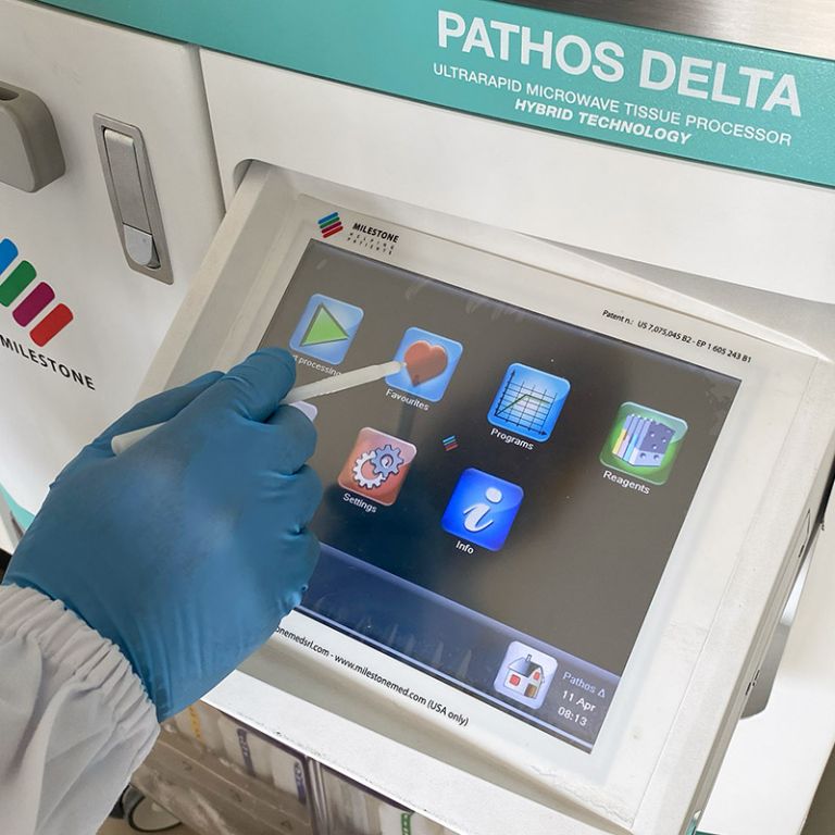 PATHOS Delta | Milestone Medical