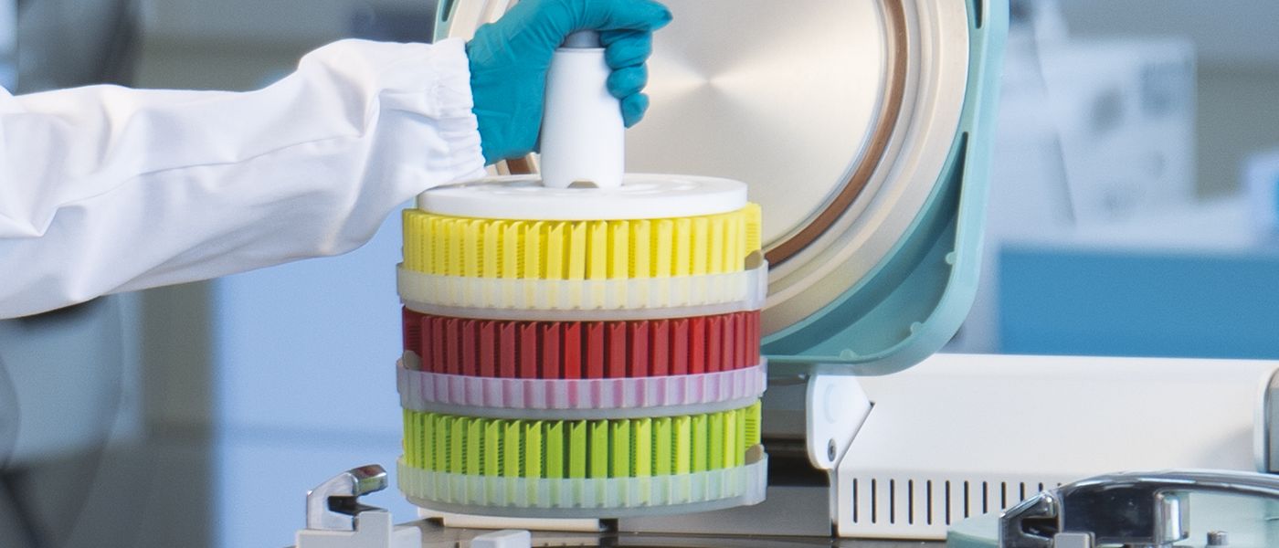 7 important parameters to choose the right Tissue Processor