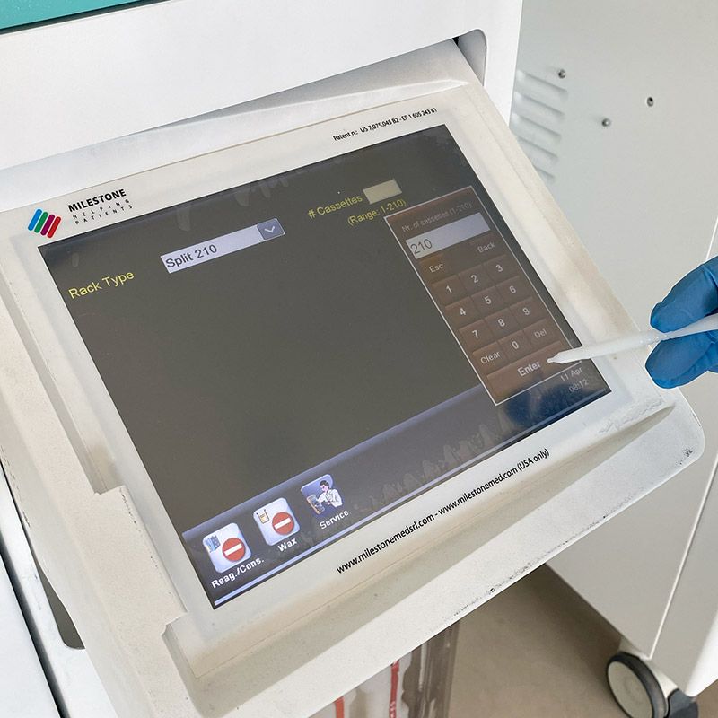 Enter the number of cassettes and start the run