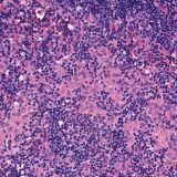 Lymph node 20X