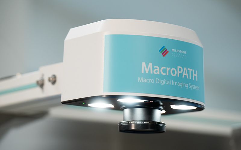 High-resolution camera