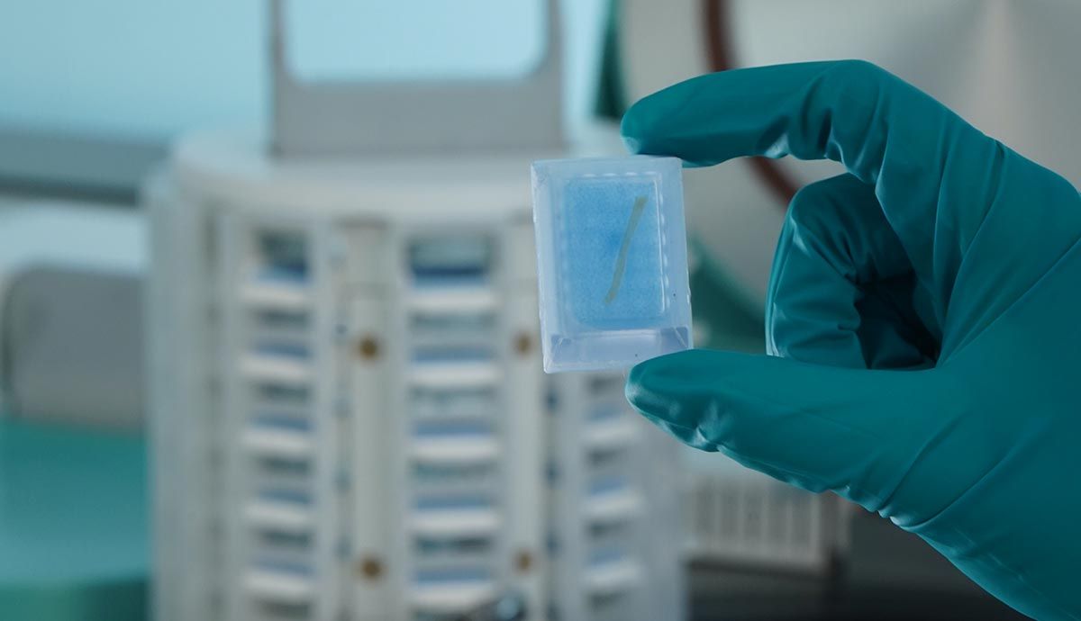 Skip the Manual Embedding Step with Synergy