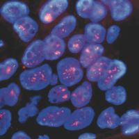 Breast cells HER2, FISH