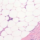 Colon fat 20X