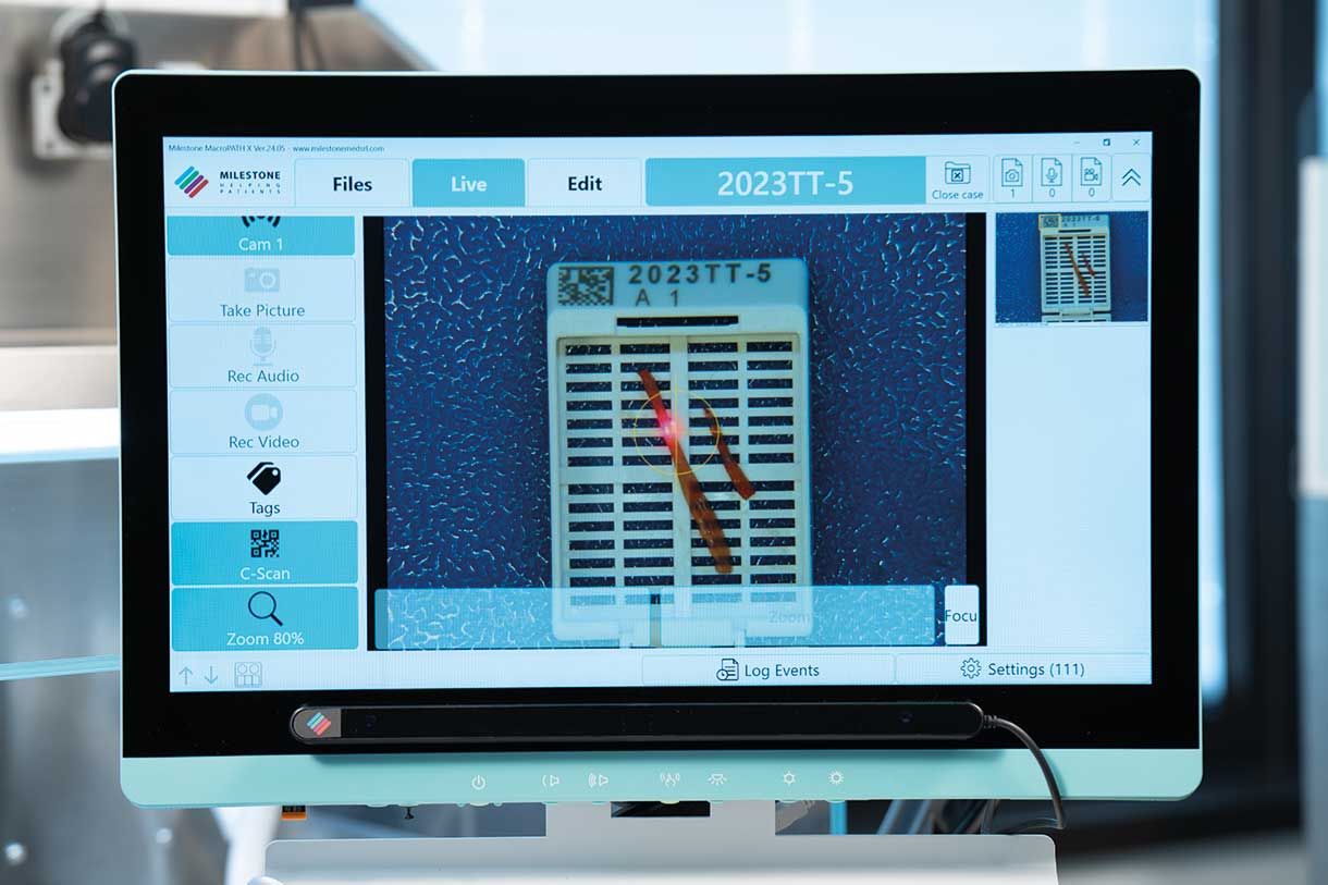 C-Scan Automatic Cassette Detecting System