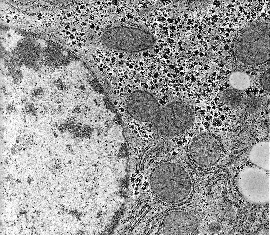 Electron Microscopy