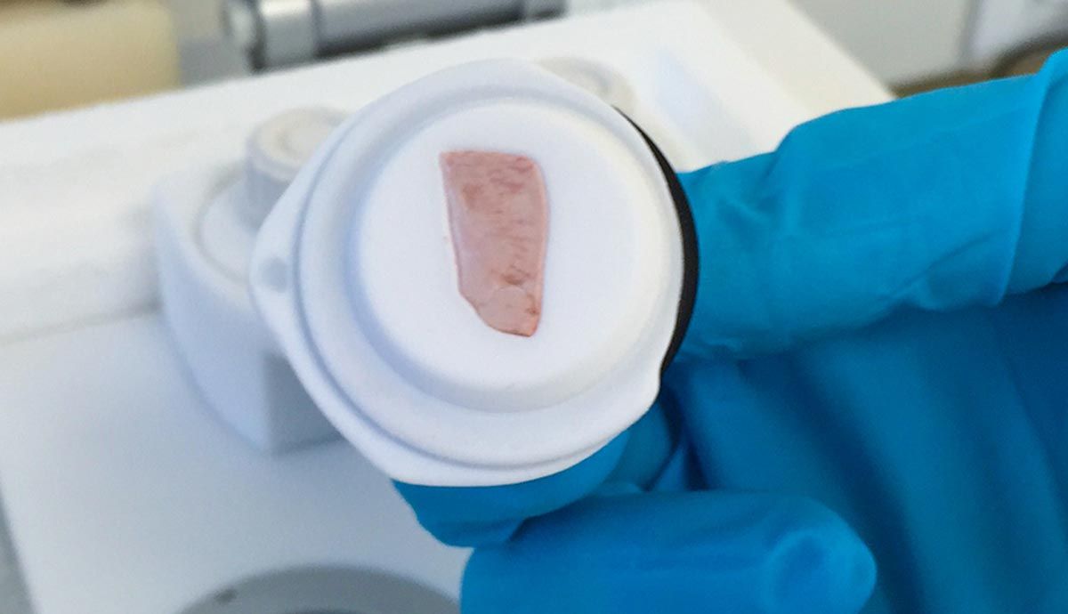 How to Enhance the Quality of your Frozen Sections