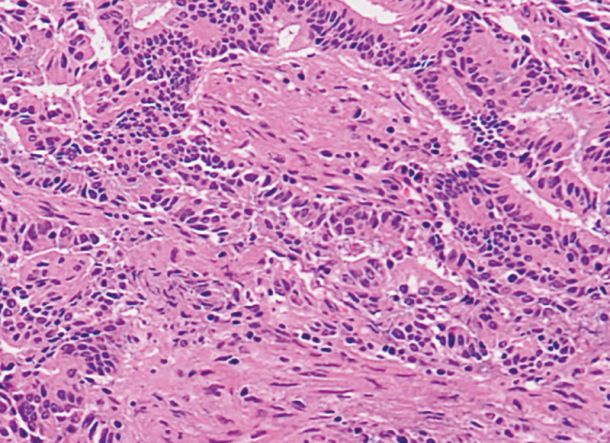 Optimal morphological preservation