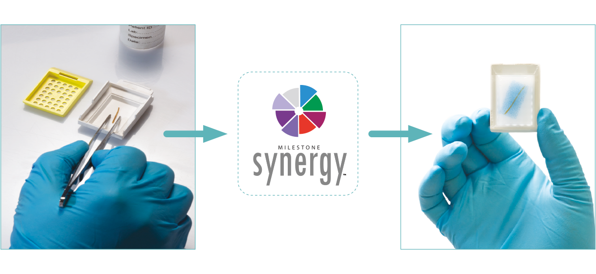 Processing Plus Embedding in One Step