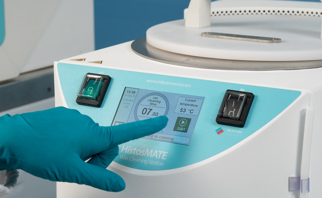 Simple and Automatic